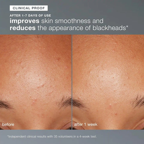daily microfoliant exfoliator