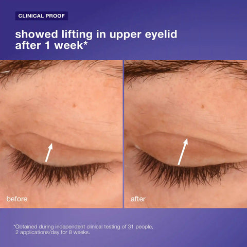 phyto nature lifting eye cream