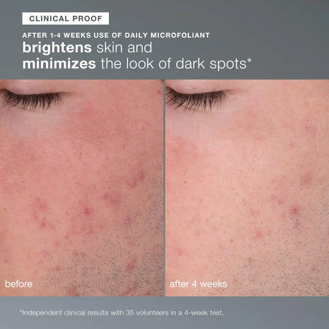 skin transformation duo
