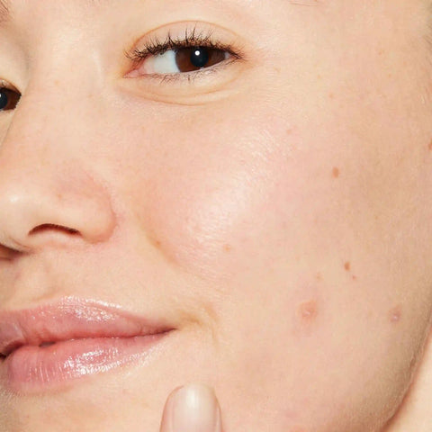 deep acne invisible liquid patch
